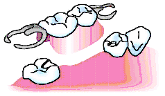 義歯の図